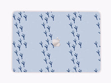 Light Blue Aesthetics - Macbook Skin