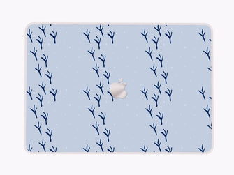Light Blue Aesthetics - Macbook Skin
